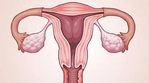试管婴儿取卵手术会疼吗？完整过程是怎样？