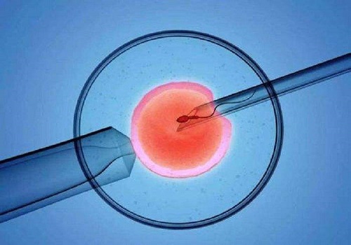试管婴儿成功率有多少？很容易就成功？